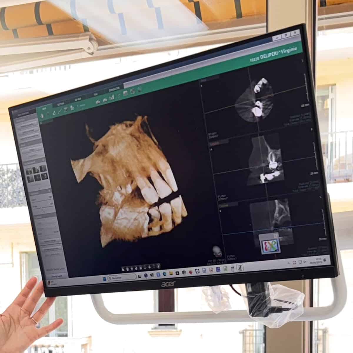 Cone-Beam-Dentistes-Alcyon-Menton-Carrees-PC-1200X1200-V1-1499